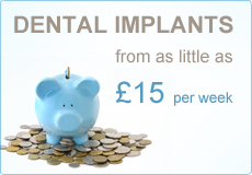 Dental Implants from £15 per week